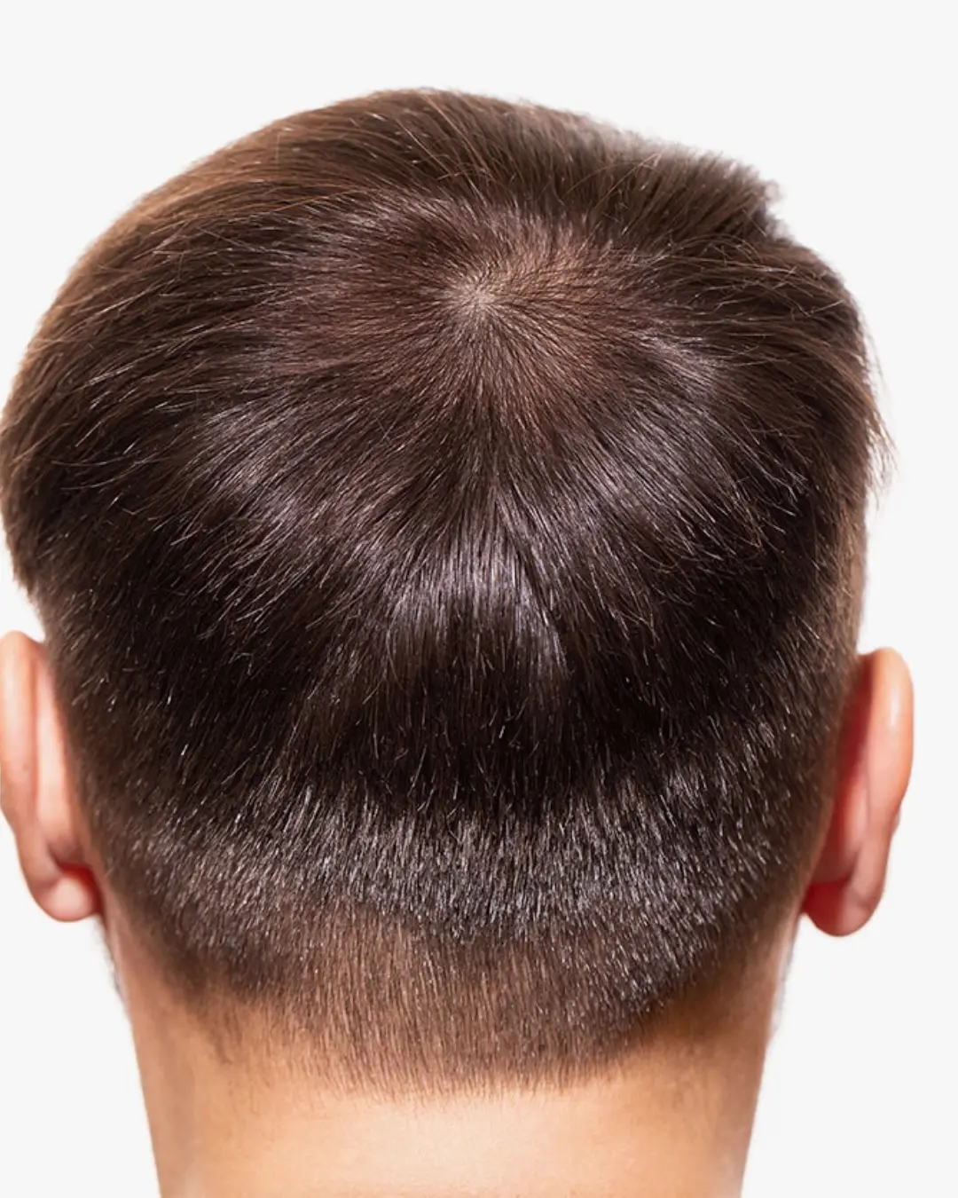 بعد حقن الخلايا الجذعية